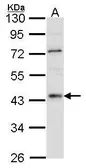 Anti-HNF4 alpha antibody [N1], N-term used in Western Blot (WB). GTX100311