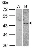 Anti-VPAC2 antibody [C2C3], C-term used in Western Blot (WB). GTX100324