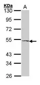 Anti-VPAC2 antibody used in Western Blot (WB). GTX100325