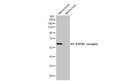 Anti-5-HT2C receptor antibody used in Western Blot (WB). GTX100329