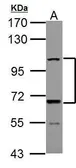 Anti-ADAMTS5 antibody used in Western Blot (WB). GTX100332