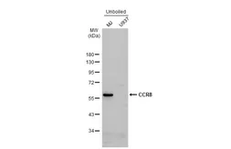 Anti-CCR8 antibody used in Western Blot (WB). GTX100343