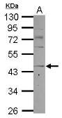 Anti-CCR8 antibody used in Western Blot (WB). GTX100343