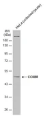 Anti-CCKBR antibody [C1C2], Internal used in Western Blot (WB). GTX100347