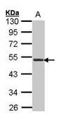 Anti-CXCR5 antibody [C1C2], Internal used in Western Blot (WB). GTX100351