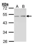 Anti-Endothelin B Receptor antibody [N1N2], N-term used in Western Blot (WB). GTX100356