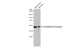 Anti-Endothelin B Receptor antibody used in Western Blot (WB). GTX100357