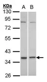 Anti-C5L2 antibody [C2C3], C-term used in Western Blot (WB). GTX100359