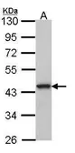 Anti-GPR20 antibody [C2C3], C-term used in Western Blot (WB). GTX100366