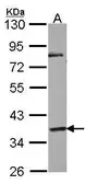 Anti-GPR45 antibody used in Western Blot (WB). GTX100369