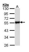 Anti-GPR54 antibody used in Western Blot (WB). GTX100373