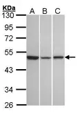 Anti-GPR54 antibody used in Western Blot (WB). GTX100374