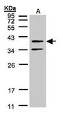 Anti-GALR2 antibody used in Western Blot (WB). GTX100382