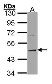 Anti-Histamine H3 Receptor antibody [C2C3], C-term used in Western Blot (WB). GTX100386