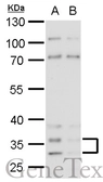 Anti-Histamine H4 Receptor antibody [N1N2], N-term used in Western Blot (WB). GTX100387
