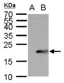 Anti-UBE2B antibody used in Western Blot (WB). GTX100416