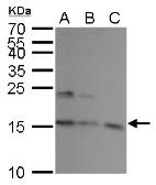 Anti-UBE2A antibody used in Western Blot (WB). GTX100426
