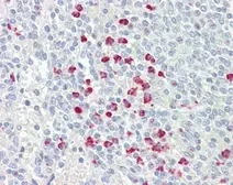 Anti-ABCG2 antibody used in IHC (Paraffin sections) (IHC-P). GTX100436