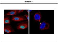 Anti-Survivin antibody used in Immunocytochemistry/ Immunofluorescence (ICC/IF). GTX100441