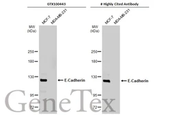 Anti-E-Cadherin antibody used in Western Blot (WB). GTX100443