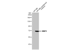 Anti-MMP9 antibody [N2C1], Internal used in Western Blot (WB). GTX100458