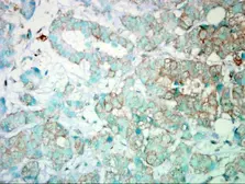 Anti-PI3 kinase p110 alpha antibody used in IHC (Paraffin sections) (IHC-P). GTX100462