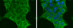 Anti-PI3 kinase p110 alpha antibody used in Immunocytochemistry/ Immunofluorescence (ICC/IF). GTX100462