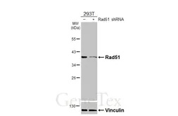 Anti-Rad51 antibody [N1C2] used in Western Blot (WB). GTX100469