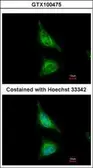 Anti-Aladin antibody [N2C2], Internal used in Immunocytochemistry/ Immunofluorescence (ICC/IF). GTX100475