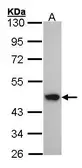 Anti-ACADM antibody used in Western Blot (WB). GTX100487