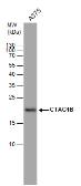 Anti-CTAG1B antibody used in Western Blot (WB). GTX100503