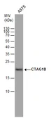 Anti-CTAG1B antibody used in Western Blot (WB). GTX100503