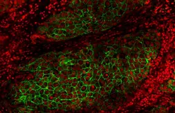 Anti-Her2 / ErbB2 antibody used in IHC (Paraffin sections) (IHC-P). GTX100509