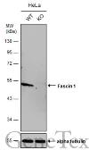Anti-Fascin 1 antibody [N2C2], Internal used in Western Blot (WB). GTX100511