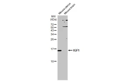 Anti-IGF1 antibody used in Western Blot (WB). GTX100521