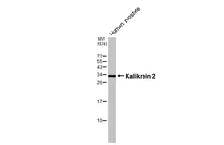 Anti-Kallikrein 2 antibody [N3C3] used in Western Blot (WB). GTX100526