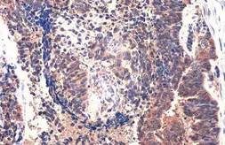 Anti-MMP1 antibody used in IHC (Paraffin sections) (IHC-P). GTX100534