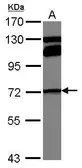 Anti-MTHFR antibody [N3C3] used in Western Blot (WB). GTX100535