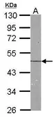 Anti-NDRG1 antibody used in Western Blot (WB). GTX100537