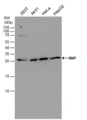 Anti-BNP antibody [N1C3] used in Western Blot (WB). GTX100538