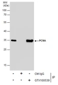 Anti-PCNA antibody used in Immunoprecipitation (IP). GTX100539