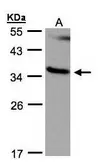 Anti-RASSF1 antibody [N1C3] used in Western Blot (WB). GTX100543