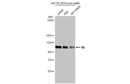 Anti-Rb antibody used in Western Blot (WB). GTX100545
