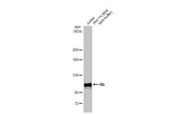 Anti-Rb antibody used in Western Blot (WB). GTX100545