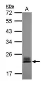 Anti-RhoC antibody used in Western Blot (WB). GTX100546