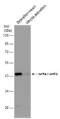 Anti-Wilms Tumor 1 antibody used in Western Blot (WB). GTX100563