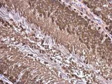 Anti-Wilms Tumor 1 antibody used in IHC (Paraffin sections) (IHC-P). GTX100563