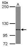 Anti-Integrin alpha 6 antibody [N3C2], Internal used in Western Blot (WB). GTX100565