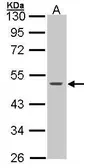 Anti-Cytokeratin 15 antibody used in Western Blot (WB). GTX100572