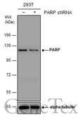 Anti-PARP antibody used in Western Blot (WB). GTX100573